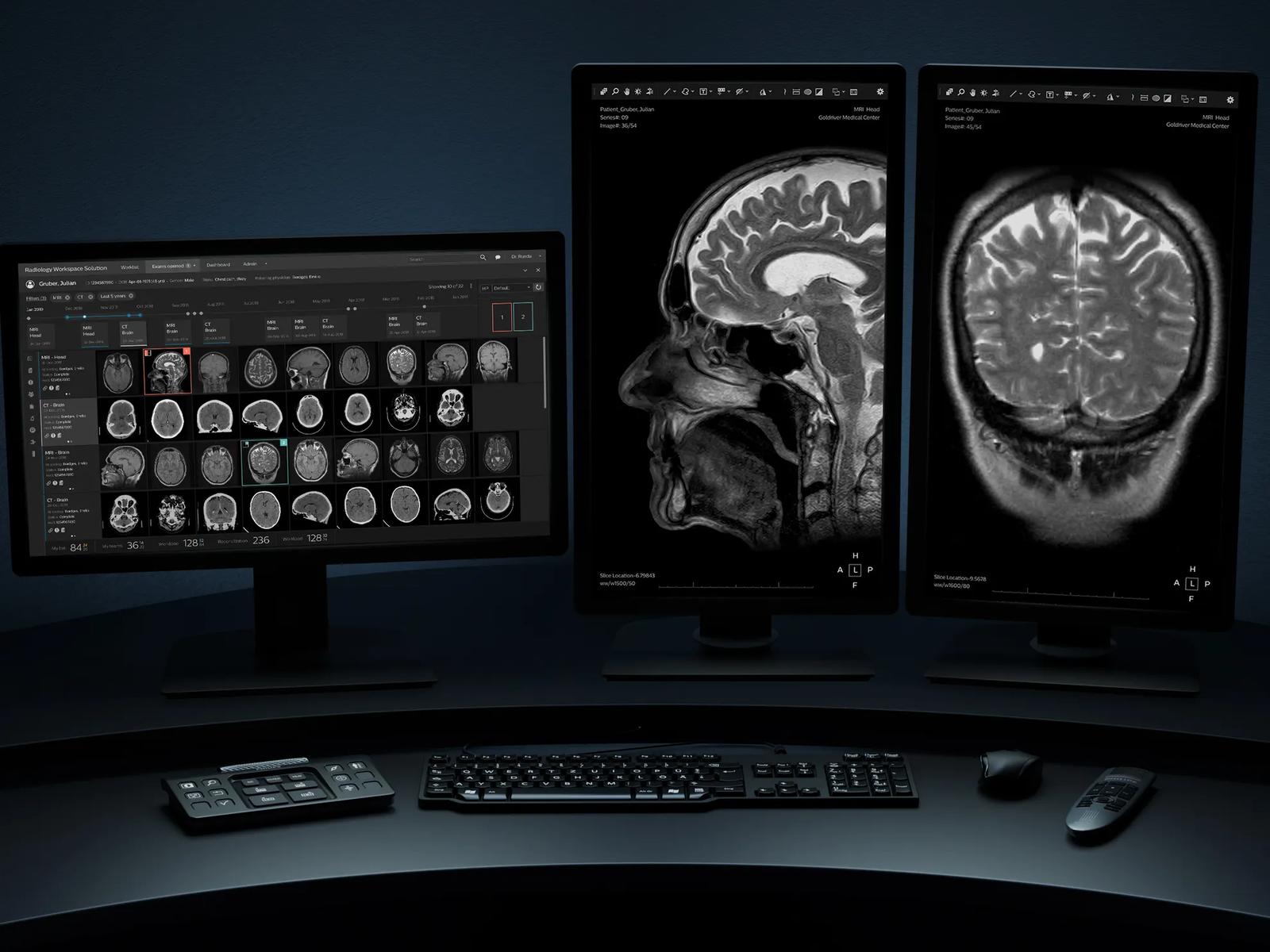 Radiology Workflow Solution